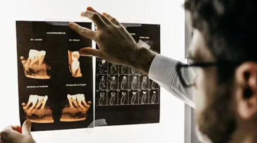 Dental4Health x ray